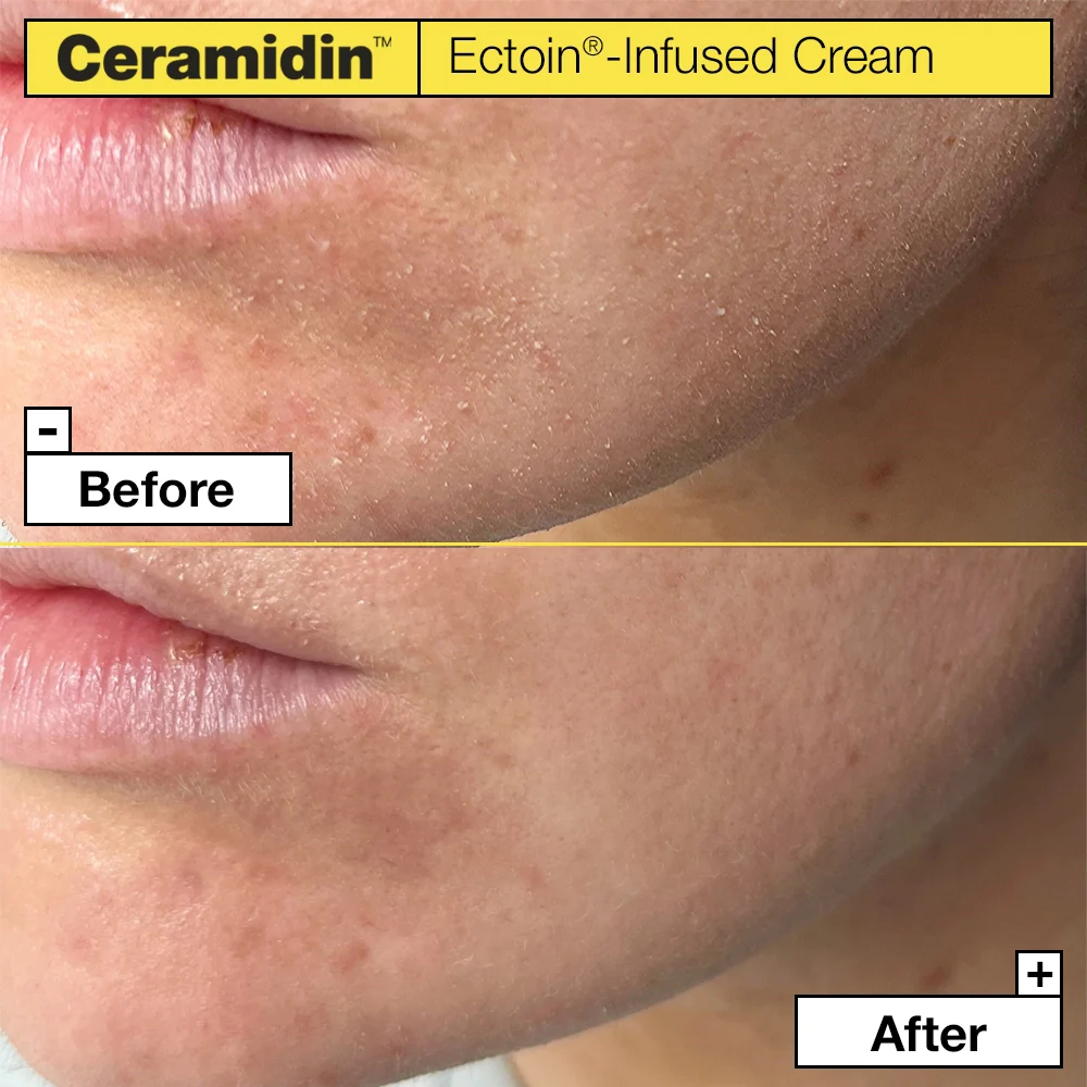 Dr.Jart+ Ceramidin Ectoin-Infused Cream 50 ml - Image 3