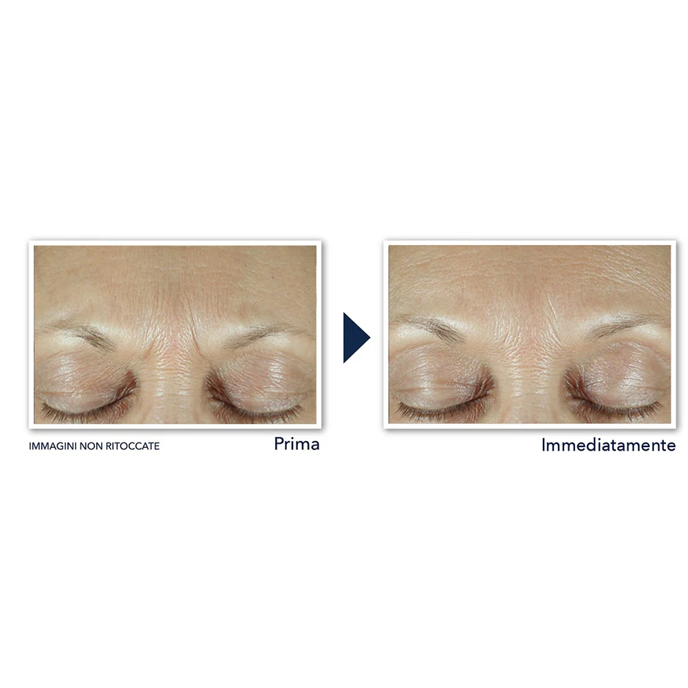 Roc Derm Correxion Sérum Combler + Traiter 15 ml - Image 4
