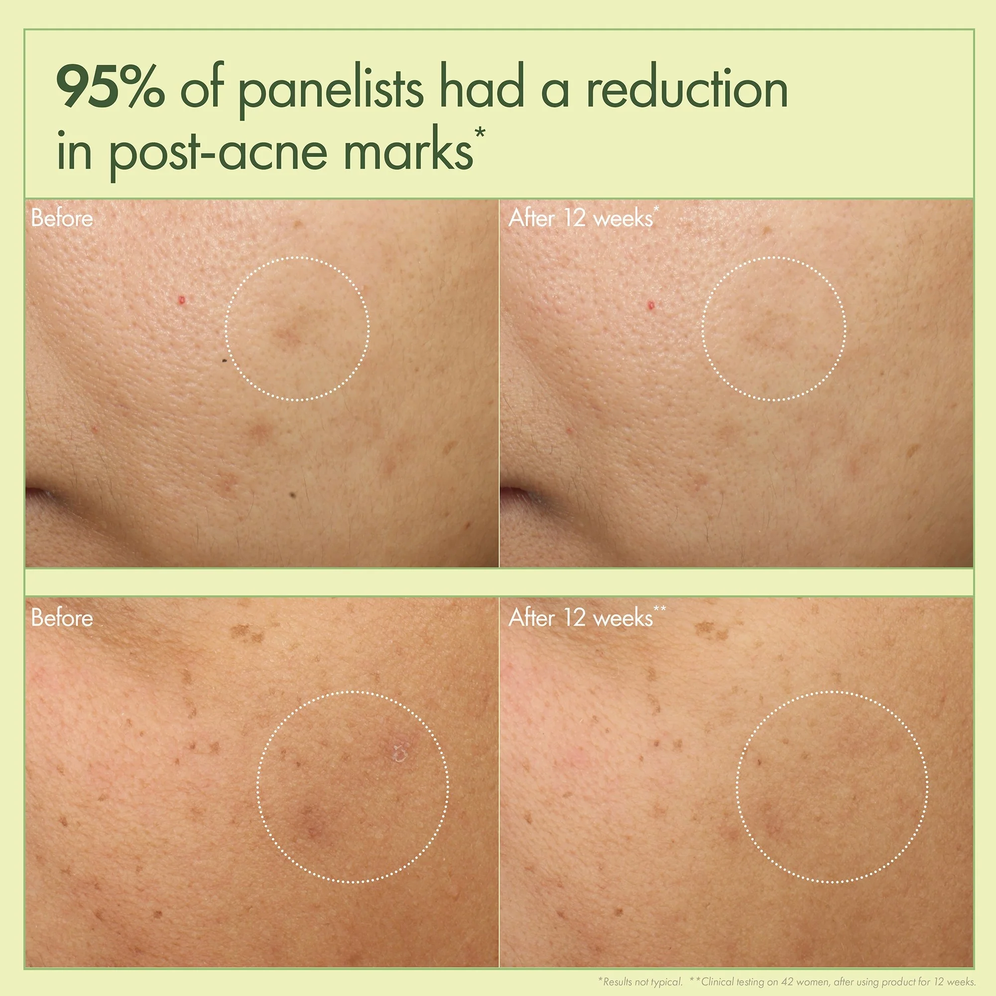 Origins Dr. Andrew Weil For Origins Mega-Mushroom Dark Spot Brightening Moisturizer 50 ml - Image 3