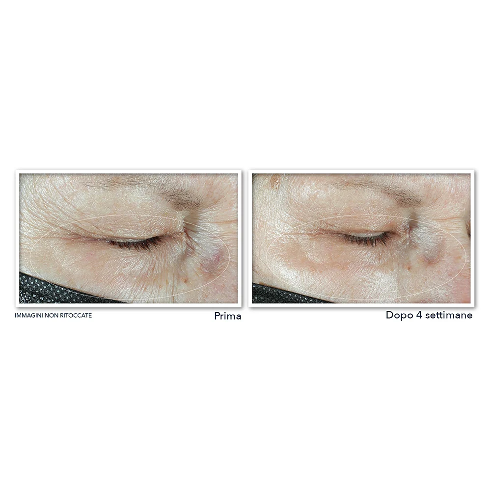 Roc Multi Correxion Hydrater + Repulper Crème Pour Les Yeux 15 ml - Image 4