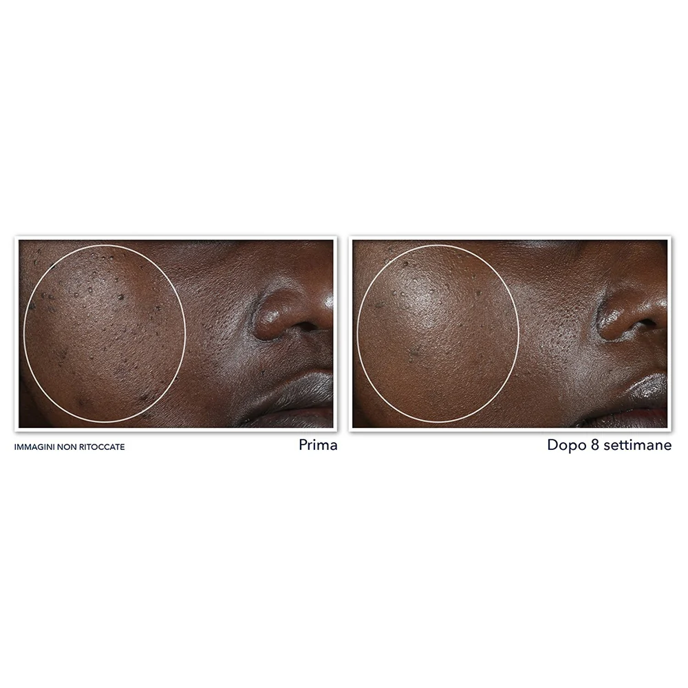 Roc Multi Correxion Unifier + Lifter Crème Nuit 50 ml - Image 4