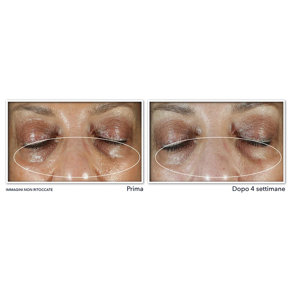 Roc Multi Correxion Unifier + Lifter Crème Pour Les Yeux 15 ml - Image 4