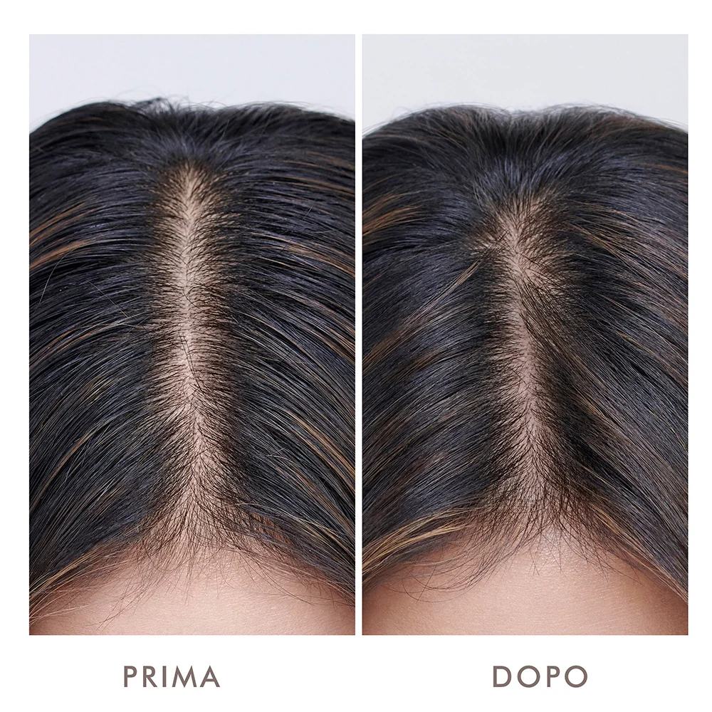 Moroccanoil Oily Scalp Treatment 45 ml - Image 4