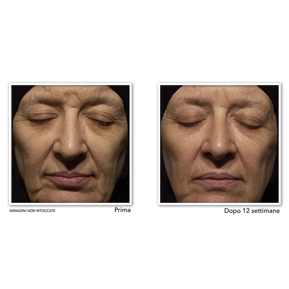 Roc Retinol Correxion Correction Rides Crème Nuit 30 ml - Image 4