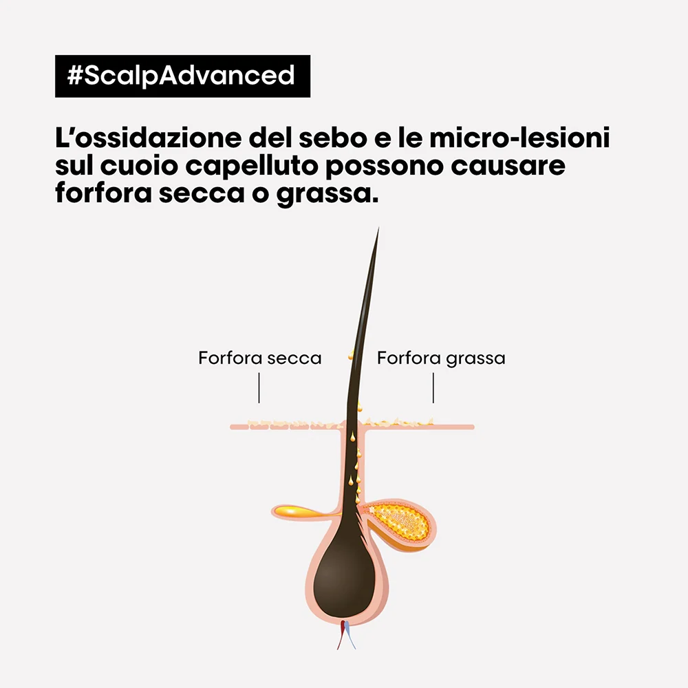 L'oreal Professionnel Scalp Advanced Anti-Dandruff 300 ml - Image 2