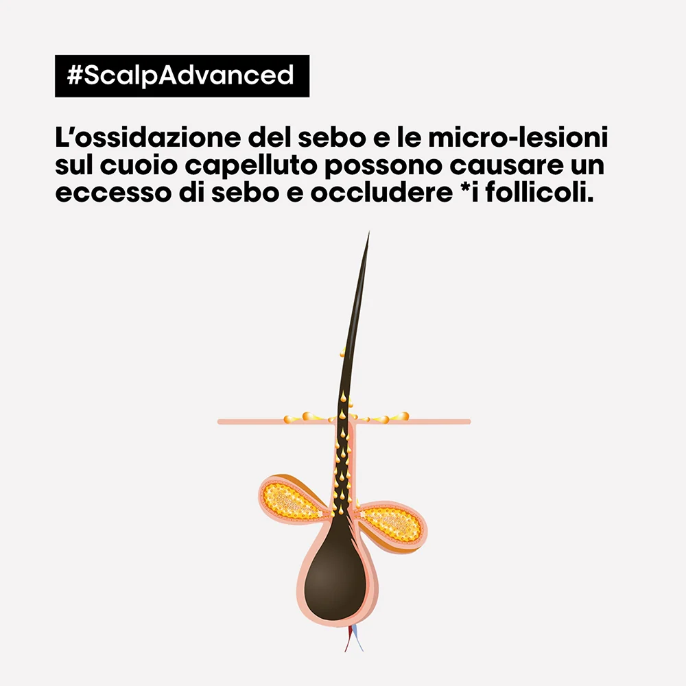 L'oreal Professionnel Scalp Advanced Anti-Oiliness 300 ml - Image 2