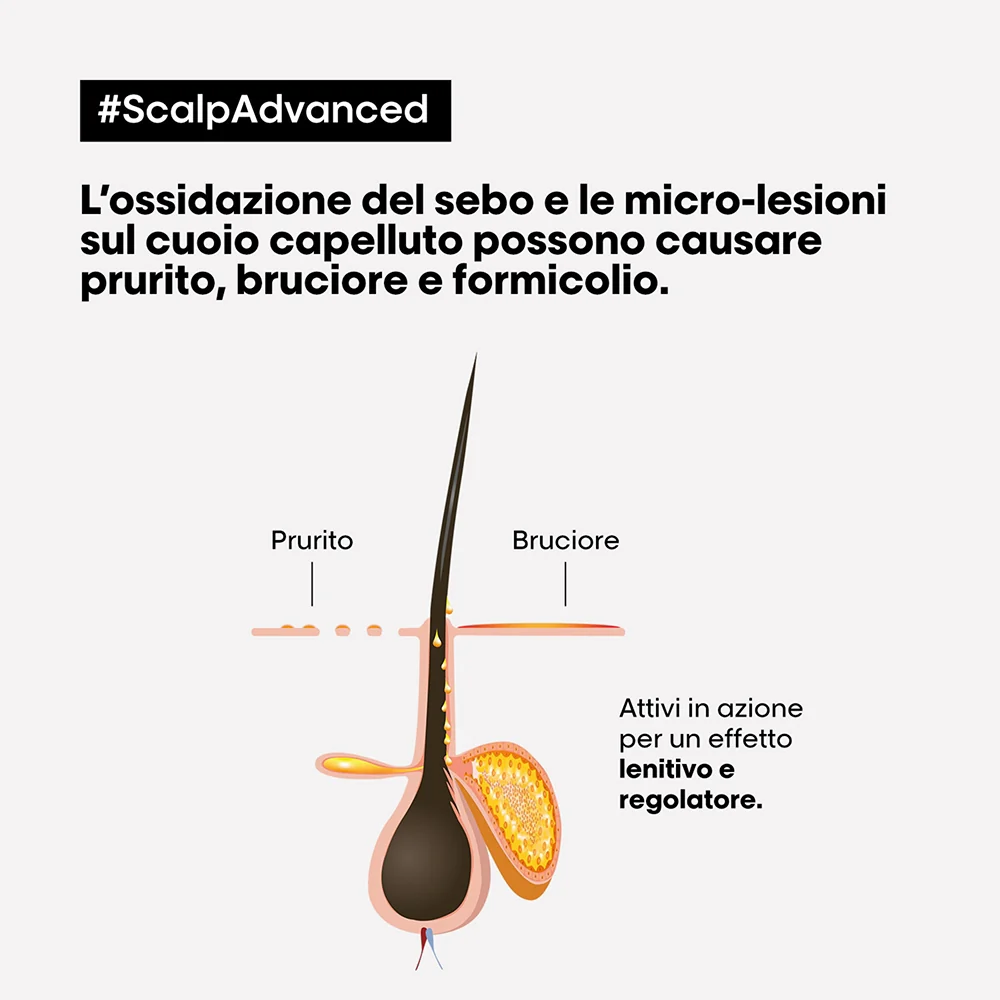 L'oreal Professionnel Scalp Advanced Trattamento Intense Soother Anti-Discomfort 200 ml - Image 2